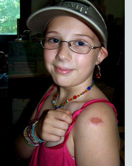 What a TERRIBLE injury!...